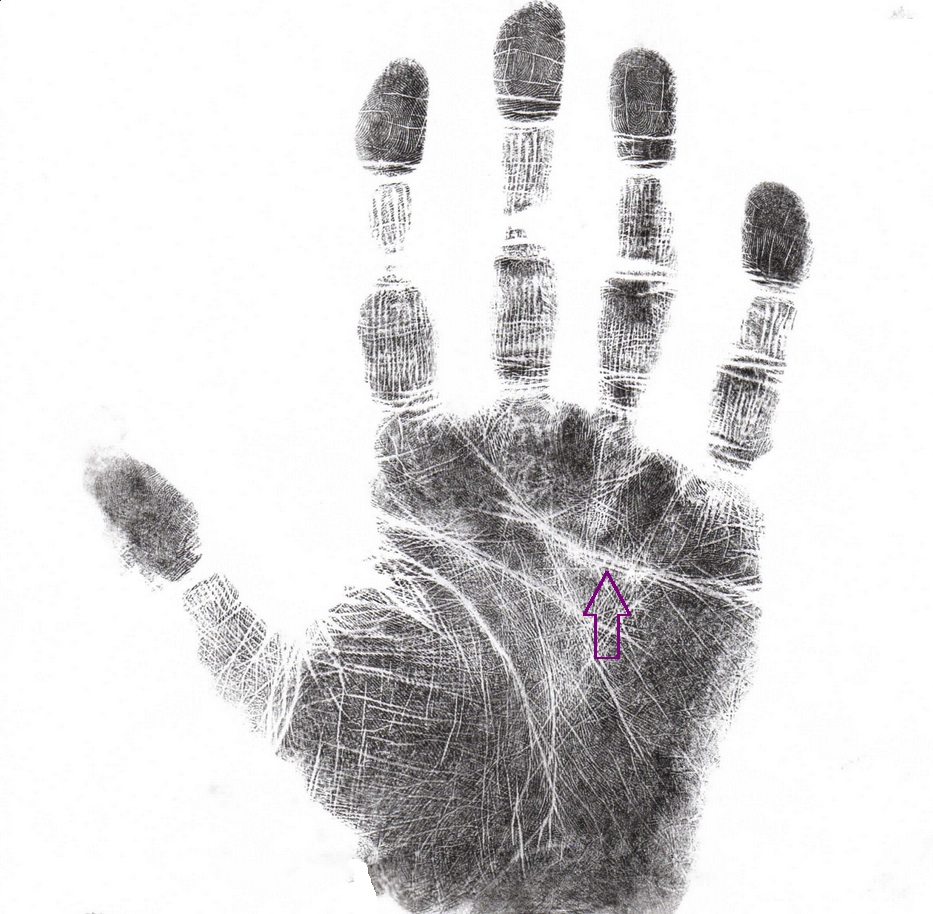 Hand analysis