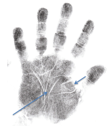 Hand analysis